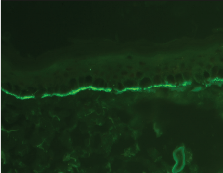 Serration pattern analysis